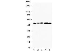 Western blot testing of TIM-1 antibody and Lane 1:  SMMC-7721;  2: HeLa;  3: PANC;  4: MM231;  5: MM453.
