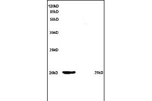 Formalin-fixed and paraffin embedded rat kidney tissue labeled with Anti Ferritin Polyclonal Antibody, Unconjugated (ABIN759641) at 1:200 followed by conjugation to the secondary antibody and DAB staining