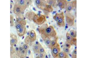 Used in DAB staining on fromalin fixed paraffin-embedded Liver tissue (CSNK1A1 anticorps  (AA 114-324))