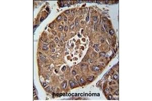 anti-ACN9 Homolog (ACN9) (AA 13-42), (N-Term) antibody