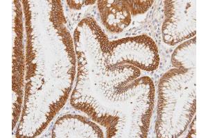 IHC-P Image Immunohistochemical analysis of paraffin-embedded human gastric tissue, using Centaurin alpha 1, antibody at 1:100 dilution. (ADAP1 anticorps  (C-Term))