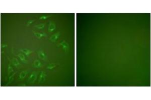 Immunofluorescence analysis of HepG2 cells, using MMP-13 Antibody.