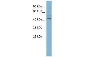 SLC46A1 antibody used at 1 ug/ml to detect target protein. (SLC46A1 anticorps)