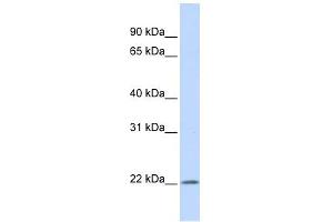 IFN Alpha 5 antibody used at 1 ug/ml to detect target protein. (IFNA5 anticorps  (Middle Region))