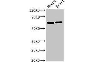 Western Blot Positive WB detected in: Rat heart tisseu, Mouse heart tissue All lanes: FASTKD2 antibody at 8 μg/mL Secondary Goat polyclonal to rabbit IgG at 1/50000 dilution Predicted band size: 82, 75 kDa Observed band size: 75 kDa (FASTKD2 anticorps  (AA 117-203))