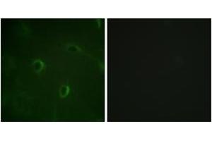 Immunofluorescence analysis of HuvEc cells, using IR (Ab-1355) Antibody. (IR (AA 1326-1375) anticorps)