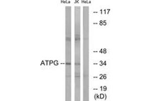 Image no. 1 for anti-ATP Synthase, H+ Transporting, Mitochondrial F1 Complex, gamma Polypeptide 1 (ATP5C1) (AA 131-180) antibody (ABIN2890140) (ATP5C1 anticorps  (AA 131-180))