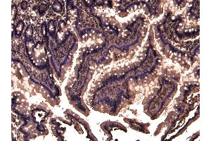 (ABIN184983) (3 μg/mL) staining of paraffin embedded Human Colon. (TRIM5 anticorps  (N-Term))