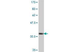 Western Blot detection against Immunogen (36. (USP45 anticorps  (AA 106-196))