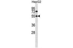 NR4A3 Antibody (C-term) western blot analysis in HepG2 cell line lysates (35µg/lane). (NR4A3 anticorps  (C-Term))