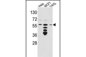 Western blot analysis of FKBP4 Antibody (Center) (ABIN391579 and ABIN2841513) in Hela,MCF7,T47D cell line lysates(35 μg/lane). (FKBP4 anticorps  (AA 186-216))