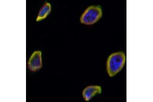 ABIN6265731 and ABIN6266699 staining Hela by IF/ICC.