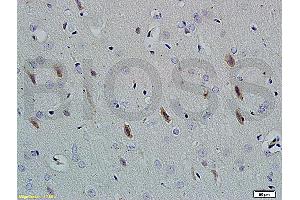 Formalin-fixed and paraffin embedded rat brain tissue labeled with Rabbit Anti-Neuroligin 1 Polyclonal Antibody (ABIN705311) at 1:200 followed by conjugation to the secondary antibody and DAB staining. (Neuroligin 1 anticorps  (AA 701-800))