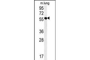 ZMYND10 Antibody (C-term) (ABIN652018 and ABIN2840499) western blot analysis in mouse lung tissue lysates (15 μg/lane).