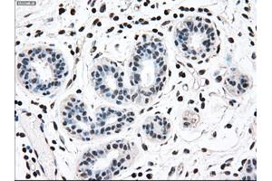 Immunohistochemical staining of paraffin-embedded breast tissue using anti-MAP2K2 mouse monoclonal antibody. (MEK2 anticorps)