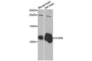 Western blot analysis of extracts of various cell lines, using S100B antibody. (S100B anticorps  (AA 1-92))