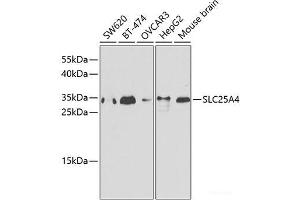 Western blot analysis of extracts of various cell lines using SLC25A4 Polyclonal Antibody. (SLC25A4 anticorps)