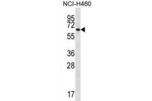 Western Blotting (WB) image for anti-Zinc Finger Protein 340 (ZNF340) antibody (ABIN2998810) (ZBTB46 anticorps)