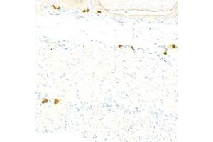 Immunohistochemistry analysis of paraffin-embedded mousestomachusing Chymase (ABIN7073506) at dilution of 1:1000 (CMA1 anticorps)