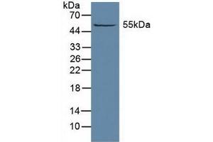 Detection of ALDH1A1 in Rat Liver Tissue using Polyclonal Antibody to Aldehyde Dehydrogenase 1 Family, Member A1 (ALDH1A1) (ALDH1A1 anticorps  (AA 2-501))