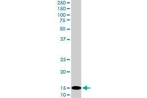 UBE2D2 monoclonal antibody (M02), clone 4A1.