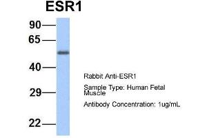 Host:  Rabbit  Target Name:  ESR1  Sample Type:  Human Fetal Muscle  Antibody Dilution:  1. (Estrogen Receptor alpha anticorps  (Middle Region))