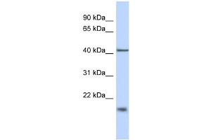 WB Suggested Anti-TBC1D21 Antibody Titration: 0. (TBC1D21 anticorps  (N-Term))