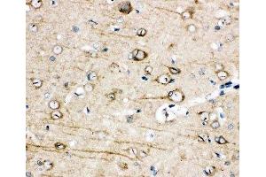 IHC-P: TRPC3 antibody testing of rat brain tissue