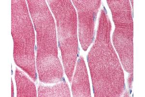 Anti-AKT1 antibody IHC of human skeletal muscle. (AKT1 anticorps  (pSer473))
