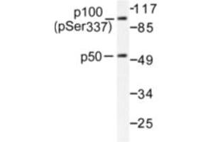 Image no. 1 for anti-Nuclear Factor of kappa Light Polypeptide Gene Enhancer in B-Cells 1 (NFKB1) (pSer337) antibody (ABIN318079) (NFKB1 anticorps  (pSer337))