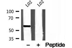 Western blot analysis of extracts of L02 cells, using CYP26B1 antibody.