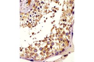 (ABIN6243764 and ABIN6578200) staining KISS1 in human testis tissue sections by Immunohistochemistry (IHC-P - paraformaldehyde-fixed, paraffin-embedded sections). (KISS1 anticorps  (AA 20-52))