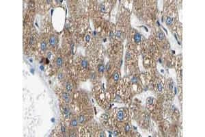 ABIN6266653 at 1/100 staining human liver tissue sections by IHC-P. (NUB1 anticorps)