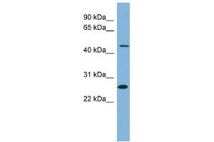 UPB1 antibody used at 1 ug/ml to detect target protein. (UPB1 anticorps  (Middle Region))