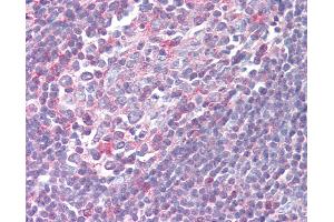 Anti-XCR1 antibody IHC of human tonsil.