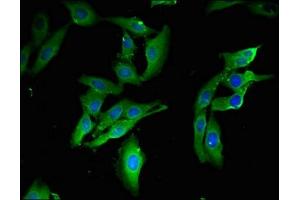 Immunofluorescent analysis of Hela cells using ABIN7172344 at dilution of 1:100 and Alexa Fluor 488-congugated AffiniPure Goat Anti-Rabbit IgG(H+L)