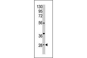 The CA9 polyclonal antibody  is used in Western blot to detect CA9 in Jurkat cell lysate. (CA9 anticorps  (N-Term))