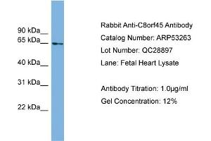WB Suggested Anti-C8orf45  Antibody Titration: 0. (C8orf45 anticorps  (Middle Region))