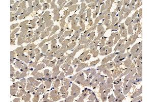 ABIN7097039 and ABIN7101106 at 1/100 staining rat heart tissue by IHC-P.