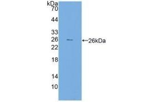 Detection of Recombinant FKBP7, Human using Polyclonal Antibody to FK506 Binding Protein 7 (FKBP7)