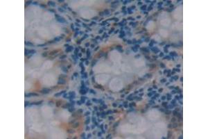 IHC-P analysis of Kidney tissue, with DAB staining. (HAUS7 anticorps  (AA 4-319))