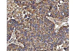 IHC analysis of HSD17B7 using anti-HSD17B7 antibody (ABIN7600174). (HSD17B7 anticorps  (AA 16-336))