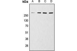 Western blot analysis of mTOR expression in HeLa (A), MCF7 (B), Jurkat (C), A431 (D) whole cell lysates. (MTOR anticorps  (C-Term))