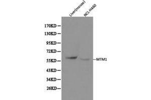 Western Blotting (WB) image for anti-Myotubularin 1 (MTM1) antibody (ABIN1873773) (MTM1 anticorps)
