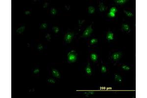 Image no. 1 for anti-Zic Family Member 4 (ZIC4) (AA 249-320) antibody (ABIN466252) (ZIC4 anticorps  (AA 249-320))