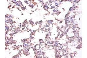Immunohistochemistry of paraffin-embedded human lung tissue using ABIN7173786 at dilution of 1:100 (LTA anticorps  (AA 39-281))