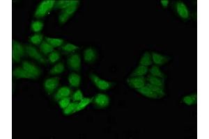Immunofluorescent analysis of Hela cells using ABIN7150376 at dilution of 1:100 and Alexa Fluor 488-congugated AffiniPure Goat Anti-Rabbit IgG(H+L)