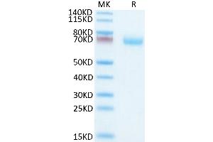 Mouse OSCAR on Tris-Bis PAGE under reduced condition.
