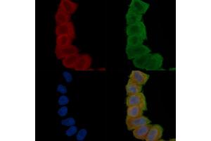 ABIN6265833 and ABIN6277102 staining Hela cells(30 min of UV treatment) by IF/ICC. (UAP1 anticorps  (Internal Region))
