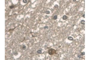 Detection of ALDOA in Human Cerebrum Tissue using Polyclonal Antibody to Aldolase A, Fructose Bisphosphate (ALDOA)